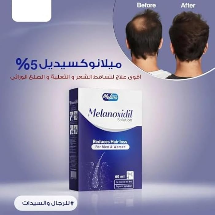 5% Topical Hair Loss Treatment Spray for Men and Women, 60 ml - Image 5